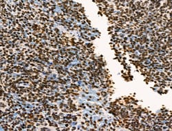 Invitrogen Phospho-BRK (Tyr447) Polyclonal Antibody 100 &mu;L; Unconjugated:Antibodies,