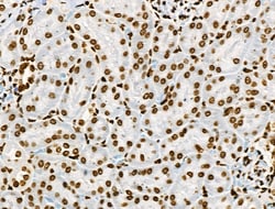 Invitrogen Phospho-BRK (Tyr447) Polyclonal Antibody 100 &mu;L; Unconjugated:Antibodies,