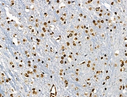 Invitrogen Phospho-BRK (Tyr447) Polyclonal Antibody 100 &mu;L; Unconjugated:Antibodies,