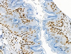 Invitrogen Phospho-BRK (Tyr447) Polyclonal Antibody 100 &mu;L; Unconjugated:Antibodies,