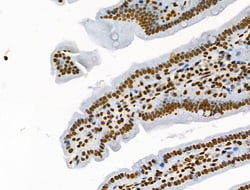 Invitrogen Phospho-BRK (Tyr447) Polyclonal Antibody 100 &mu;L; Unconjugated:Antibodies,