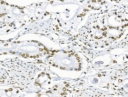 Invitrogen Phospho-BRK (Tyr447) Polyclonal Antibody 100 &mu;L; Unconjugated:Antibodies,