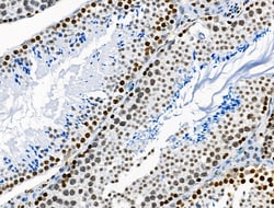 Invitrogen Phospho-BRK (Tyr447) Polyclonal Antibody 100 &mu;L; Unconjugated:Antibodies,