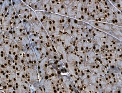 Invitrogen Phospho-BRK (Tyr447) Polyclonal Antibody 100 &mu;L; Unconjugated:Antibodies,