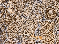 Invitrogen Phospho-BRK (Tyr447) Polyclonal Antibody 100 &mu;L; Unconjugated:Antibodies,