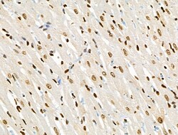 Invitrogen Phospho-BRK (Tyr447) Polyclonal Antibody 100 &mu;L; Unconjugated:Antibodies,