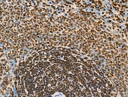 Invitrogen Phospho-BRK (Tyr447) Polyclonal Antibody 100 &mu;L; Unconjugated:Antibodies,