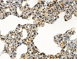 Invitrogen Phospho-BRK (Tyr447) Polyclonal Antibody 100 &mu;L; Unconjugated:Antibodies,
