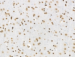 Invitrogen Phospho-BRK (Tyr447) Polyclonal Antibody 100 &mu;L; Unconjugated:Antibodies,