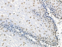 Invitrogen Phospho-BRK (Tyr447) Polyclonal Antibody 100 &mu;L; Unconjugated:Antibodies,