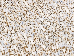 Invitrogen Phospho-BRK (Tyr447) Polyclonal Antibody 100 &mu;L; Unconjugated:Antibodies,