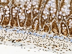 Invitrogen Phospho-BRK (Tyr447) Polyclonal Antibody 100 &mu;L; Unconjugated:Antibodies,