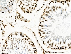 Invitrogen Phospho-BRK (Tyr447) Polyclonal Antibody 100 &mu;L; Unconjugated:Antibodies,