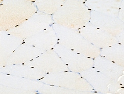 Invitrogen Phospho-BRK (Tyr447) Polyclonal Antibody 100 &mu;L; Unconjugated:Antibodies,