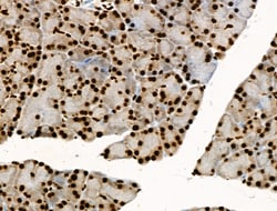 Invitrogen Phospho-BRK (Tyr447) Polyclonal Antibody 100 &mu;L; Unconjugated:Antibodies,