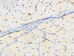 Invitrogen Phospho-BRK (Tyr447) Polyclonal Antibody 100 &mu;L; Unconjugated:Antibodies,
