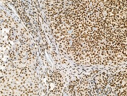 Invitrogen Phospho-BRK (Tyr447) Polyclonal Antibody 100 &mu;L; Unconjugated:Antibodies,