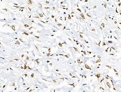 Invitrogen Phospho-BRK (Tyr447) Polyclonal Antibody 100 &mu;L; Unconjugated:Antibodies,
