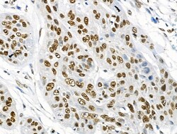 Invitrogen Phospho-BRK (Tyr447) Polyclonal Antibody 100 &mu;L; Unconjugated:Antibodies,