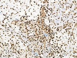 Invitrogen Phospho-BRK (Tyr447) Polyclonal Antibody 100 &mu;L; Unconjugated:Antibodies,