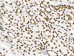 Invitrogen Phospho-BRK (Tyr447) Polyclonal Antibody 100 &mu;L; Unconjugated:Antibodies,