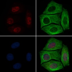 Invitrogen Phospho-RUNX2 (Ser340) Polyclonal Antibody 100 &mu;L; Unconjugated:Antibodies,