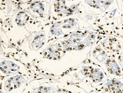 Invitrogen Phospho-GIT2 (Tyr592) Polyclonal Antibody 100 &mu;L; Unconjugated:Antibodies,