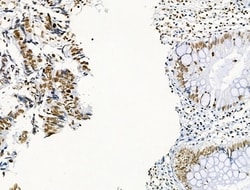 Invitrogen Phospho-GIT2 (Tyr592) Polyclonal Antibody 100 &mu;L; Unconjugated:Antibodies,