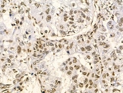 Invitrogen Phospho-GIT2 (Tyr592) Polyclonal Antibody 100 &mu;L; Unconjugated:Antibodies,