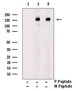 Invitrogen Phospho-ErbB4 (Tyr984) Polyclonal Antibody 100 &mu;L; Unconjugated:Antibodies,