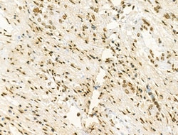 Invitrogen Phospho-IRF4 (Tyr122, Tyr125) Polyclonal Antibody 100 &mu;L;