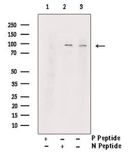 Invitrogen Phospho-RSK1 (Thr573) Polyclonal Antibody 100 &mu;L | Buy Online | Invitrogen&trade; | Fisher Scientific