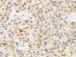 Invitrogen Phospho-RSK1 (Thr573) Polyclonal Antibody 100 &mu;L | Buy Online | Invitrogen&trade; | Fisher Scientific