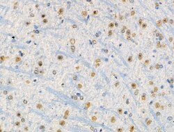 Invitrogen Phospho-RSK1 (Thr573) Polyclonal Antibody 100 &mu;L | Buy Online | Invitrogen&trade; | Fisher Scientific