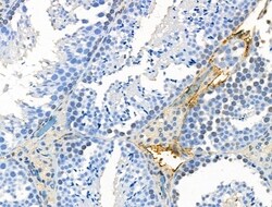 Invitrogen Phospho-CD226 (Ser329) Polyclonal Antibody 100 &mu;L; Unconjugated:Antibodies,