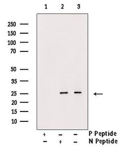 Invitrogen Phospho-MOB4A (Thr35) Polyclonal Antibody 100 μL; Unconjugated:Antibodies,