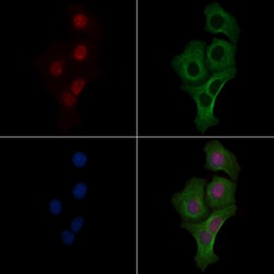 Phospho-DBC1 (Thr454) Polyclonal Antibody:Antibodies, Polyclonal