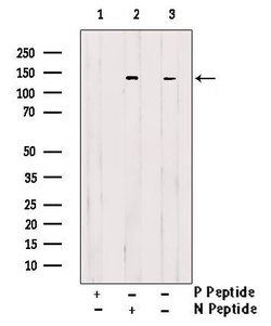 Phospho-DBC1 (Thr454) Polyclonal Antibody:Antibodies, Polyclonal