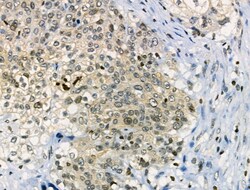 Invitrogen Phospho-CAMKK2 (Ser511) Polyclonal Antibody 100 &mu;L; Unconjugated:Antibodies,