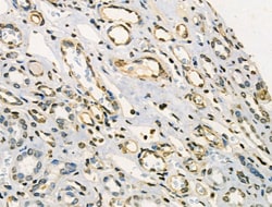 Invitrogen Phospho-CAMKK2 (Ser511) Polyclonal Antibody 100 &mu;L; Unconjugated:Antibodies,