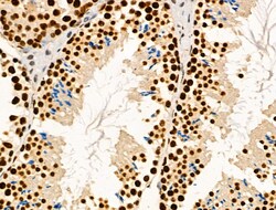 Invitrogen Phospho-MNK1 (Thr250, Thr255) Polyclonal Antibody 100 μL;