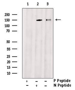 Invitrogen Phospho-BRIP1 (Thr1133) Polyclonal Antibody 100 &mu;L; Unconjugated:Antibodies,