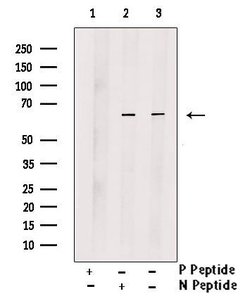 Invitrogen Phospho-PINK1 (Thr313) Polyclonal Antibody 100 &mu;L | Buy Online | Invitrogen&trade; | Fisher Scientific