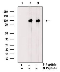 Invitrogen Phospho-CDCP1 (Tyr707) Polyclonal Antibody 100 &mu;L; Unconjugated:Antibodies,