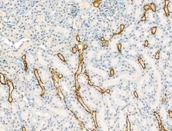 Invitrogen Phospho-CYLD (Ser418) Polyclonal Antibody 100 μL; Unconjugated:Antibodies,