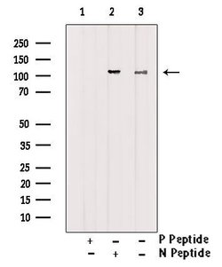 Invitrogen Phospho-CYLD (Ser418) Polyclonal Antibody 100 μL; Unconjugated:Antibodies,