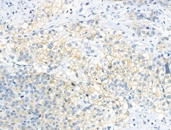 Invitrogen Phospho-DAPP1 (Tyr139) Polyclonal Antibody 100 &mu;L; Unconjugated:Antibodies,