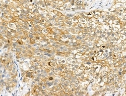 Phospho-GAB2 (Ser159) Polyclonal Antibody:Antibodies, Polyclonal