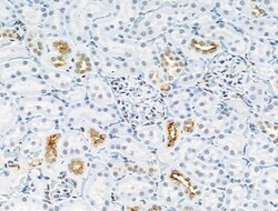 Phospho-GAB2 (Ser159) Polyclonal Antibody:Antibodies, Polyclonal