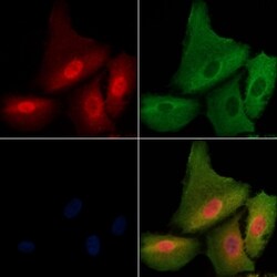 Invitrogen Phospho-ATF6 (Thr166) Polyclonal Antibody 100 &mu;L; Unconjugated:Antibodies,